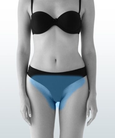 Pack (Rebaje total + Intergluteo) - Santiago